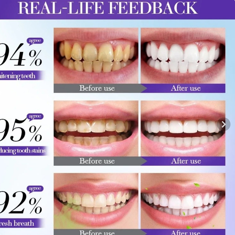 موس سفید کننده دندان سادور مدل Brighten Whiten 🦷✨ حجم ۶۰ میلی لیتر