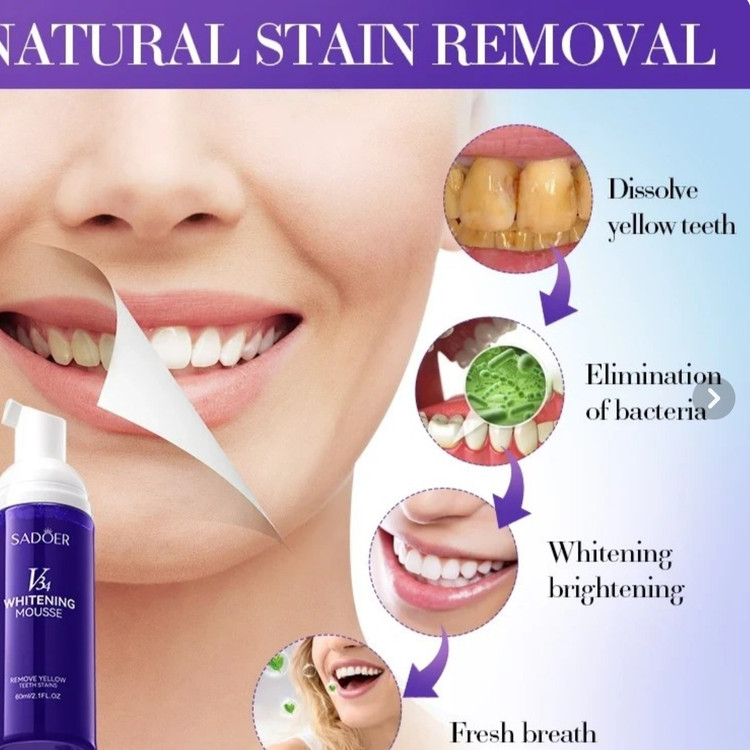 موس سفید کننده دندان سادور مدل Brighten Whiten 🦷✨ حجم ۶۰ میلی لیتر