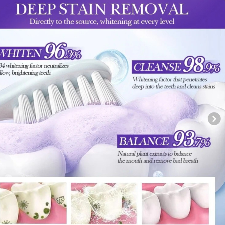 موس سفید کننده دندان سادور مدل Brighten Whiten 🦷✨ حجم ۶۰ میلی لیتر